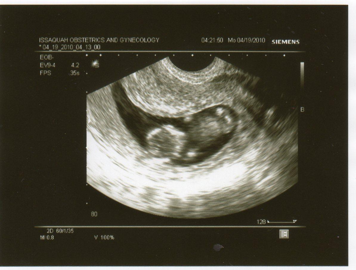 jessica-s-baby-blog-ultrasound-pictures-week-6-12
