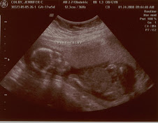 Me 17 weeks along