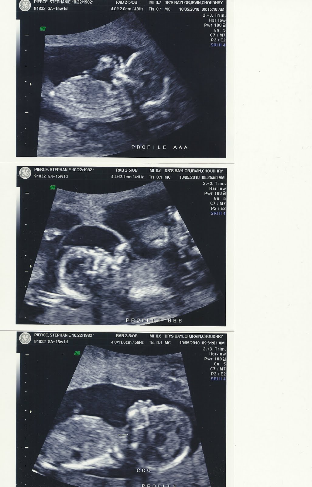 What triplets Dr Appt For 15 Weeks what-triplets-dr-appt-for-15-weeks
