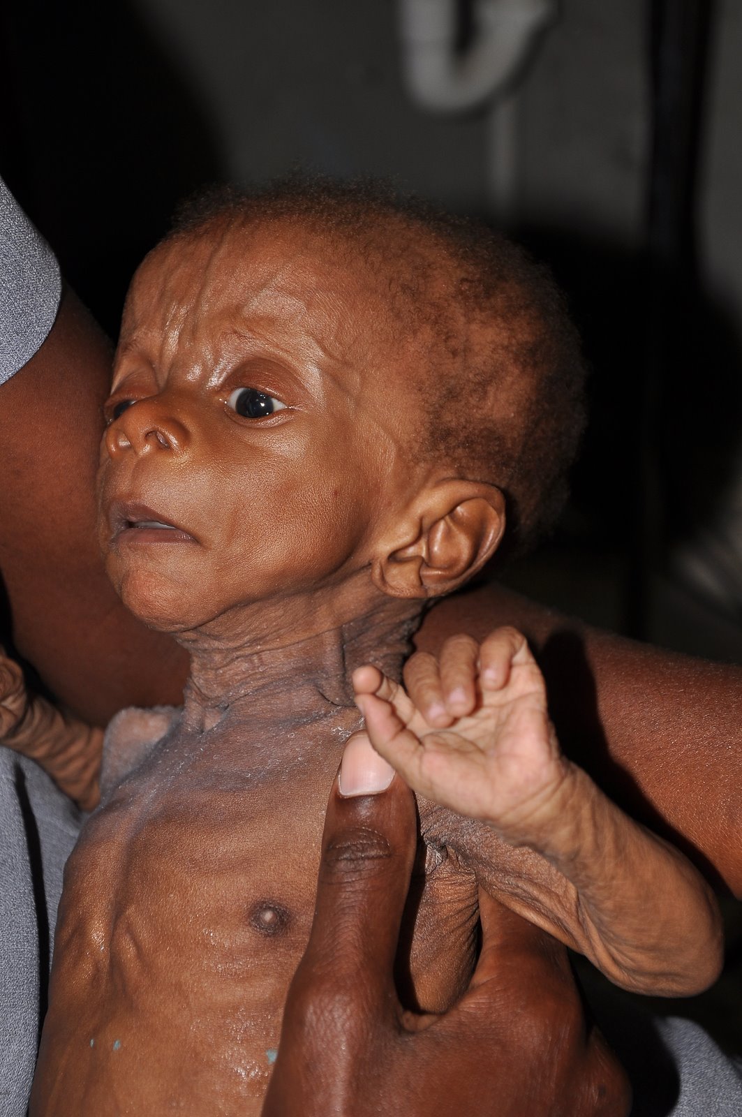 Dying in Haiti Les Cayes, Haiti