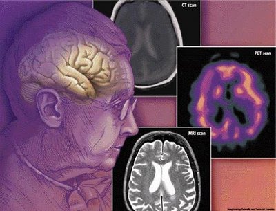 [picture+brain.bmp]