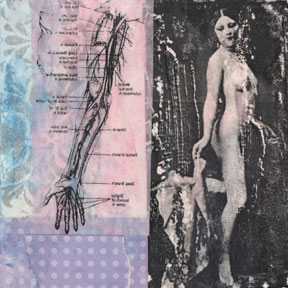 [klimtsarm052608.jpg]