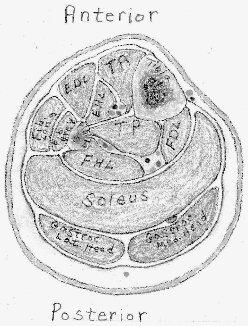 The Injured Athlete Chronic Exertional Compartment Syndrome