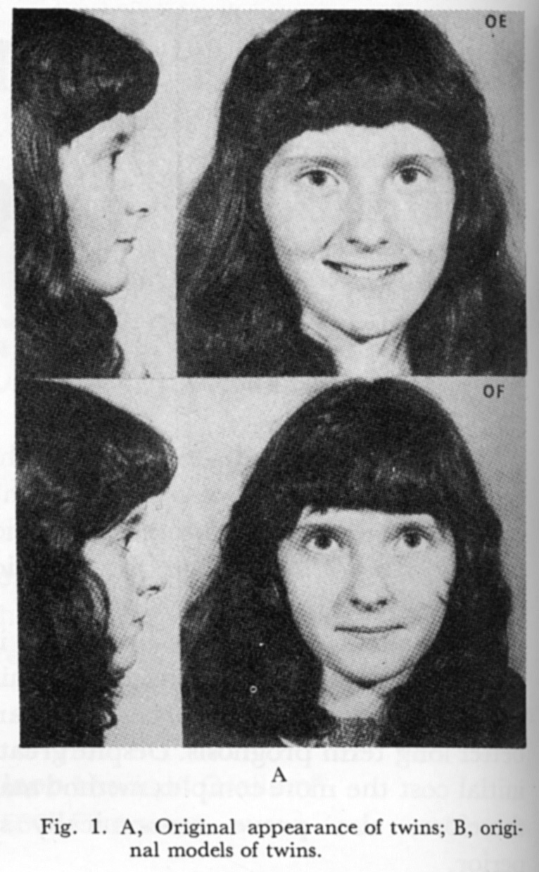 [Twins+before.jpg]