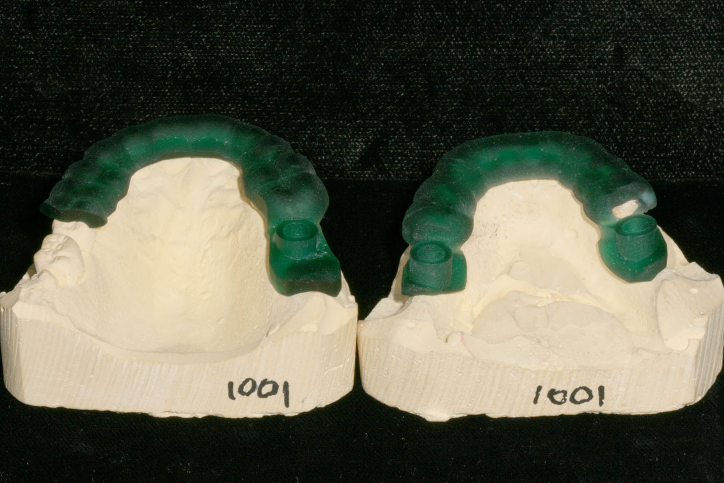 CBCT News Room: BlueSky Plan Now Offers Two New Surical Guide Techniques!