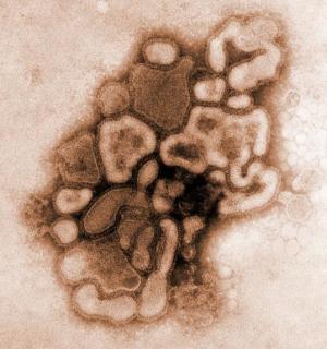 [H1N1+flu.jpg]